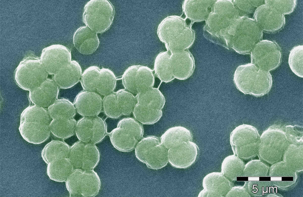 Cyanobacteria